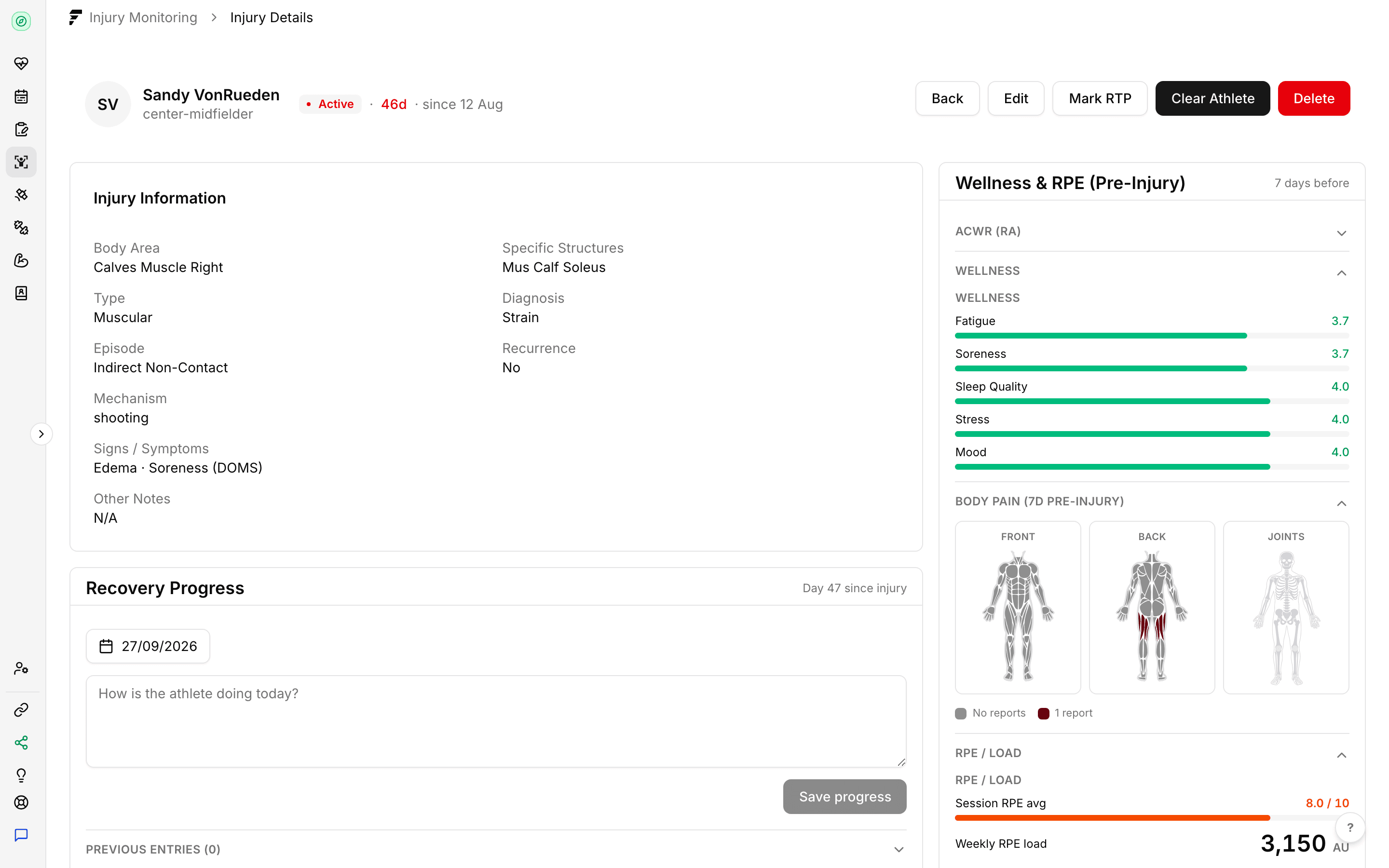Fractall injury record for a calf strain with its Active status, days out, Mark RTP and Clear Athlete actions, and the wellness, body pain and RPE snapshot from before the injury