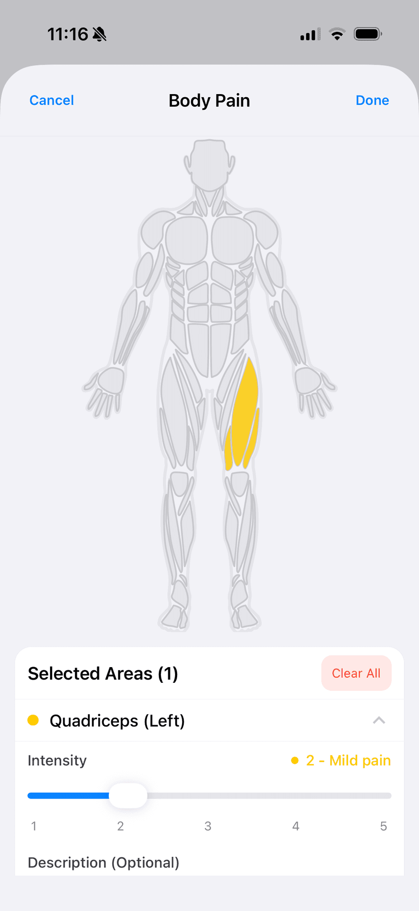 Fractall mobile app — athlete body pain map screen showing anatomical region selection with intensity and pain type